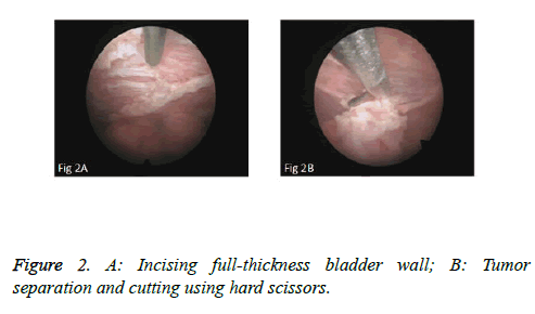 biomedres-pin-bladder-wall