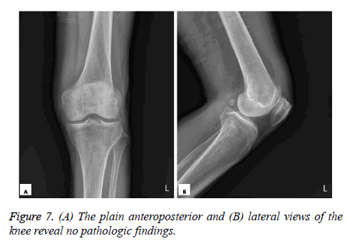 biomedres-plain-anteroposterior