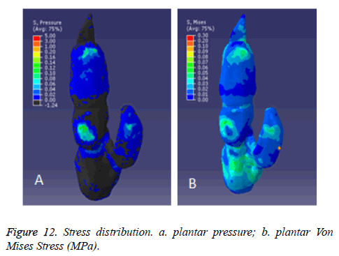 biomedres-plantar-pressure