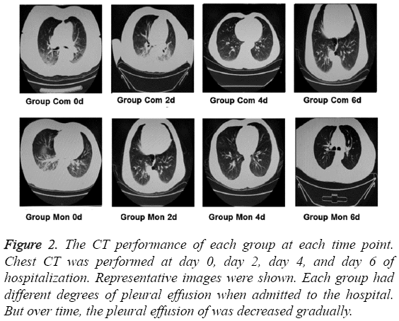 biomedres-pleural-effusion-decreased