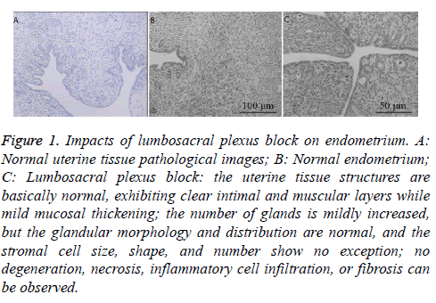 biomedres-plexus-block