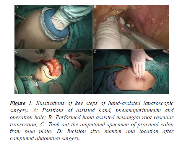 biomedres-pneumoperitoneum