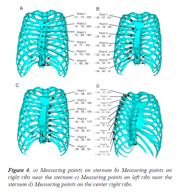 biomedres-points-sternum