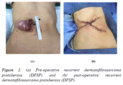 biomedres-post-operative