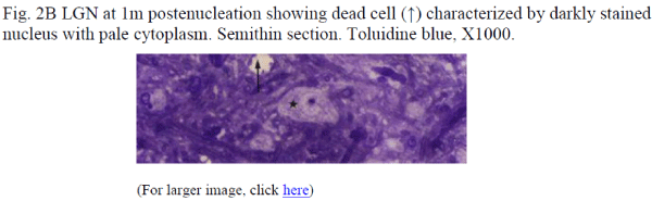 biomedres-postenucleation