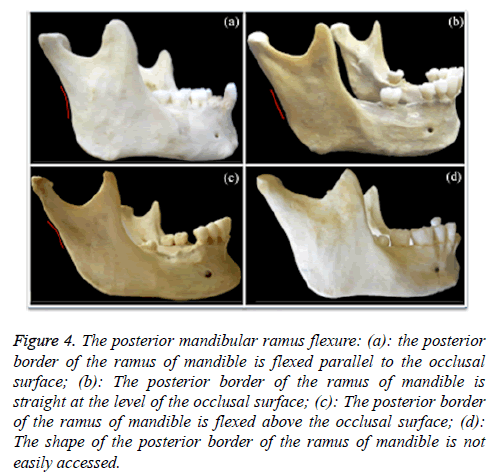 biomedres-posterior-mandibular