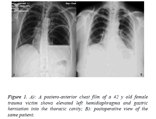 biomedres-postero-anterior