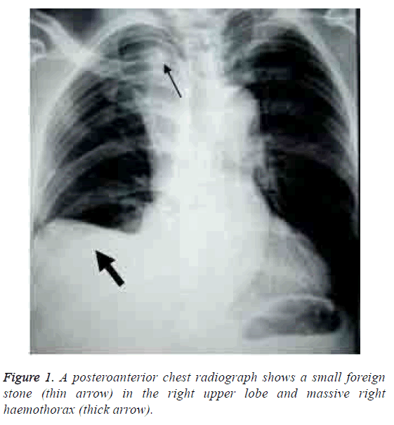 biomedres-posteroanterior-radiograph