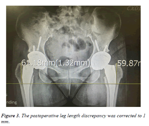 biomedres-postoperative-leg