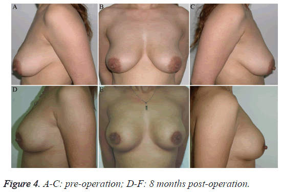 biomedres-pre-post-operation