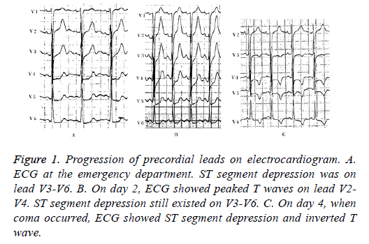 biomedres-precordial-leads