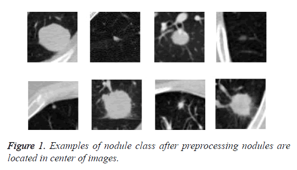 biomedres-preprocessing-nodules