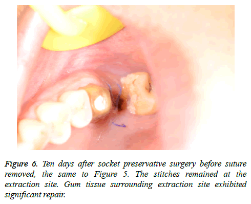 biomedres-preservative-surgery