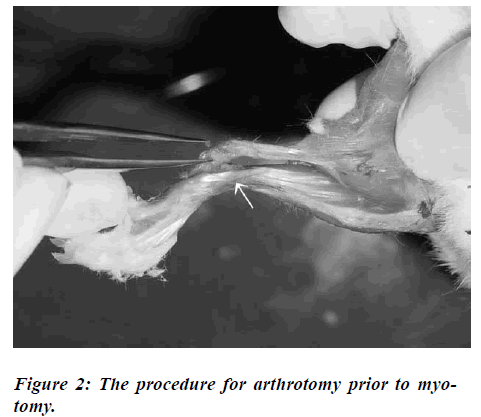 biomedres-procedure-arthrotomy