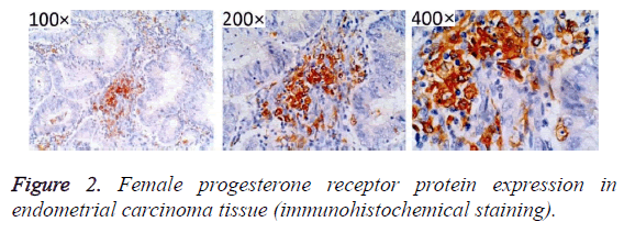 biomedres-progesterone-receptor