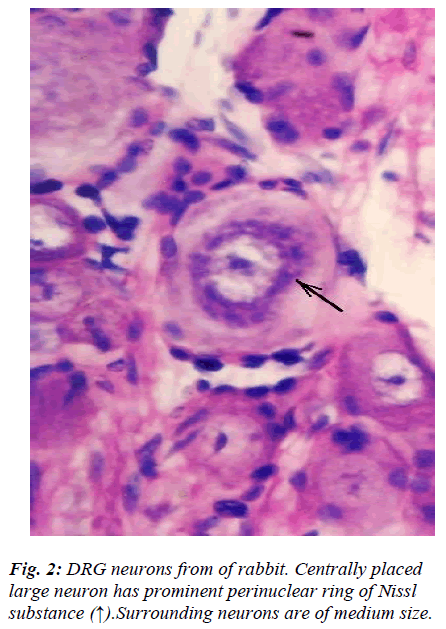 biomedres-prominent-perinuclear-ring-Nissl