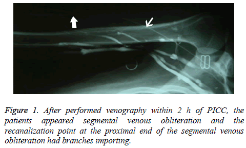 biomedres-proximal-end