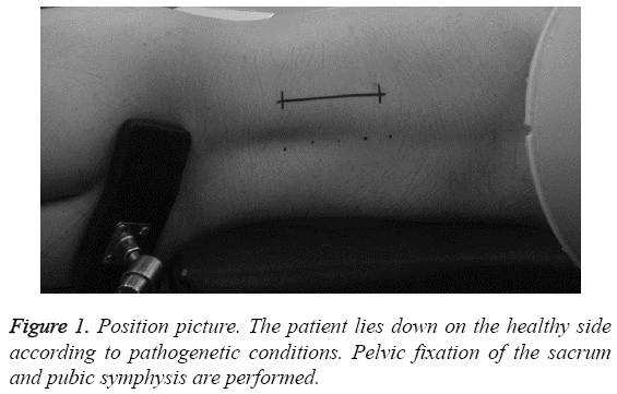 biomedres-pubic-symphysis-performed