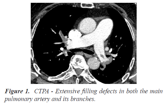 biomedres-pulmonary