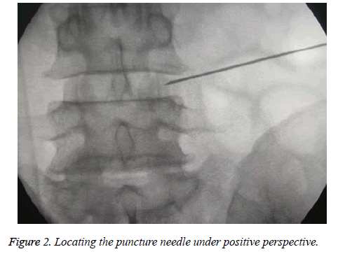 biomedres-puncture-needle