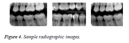 biomedres-radiographic-images