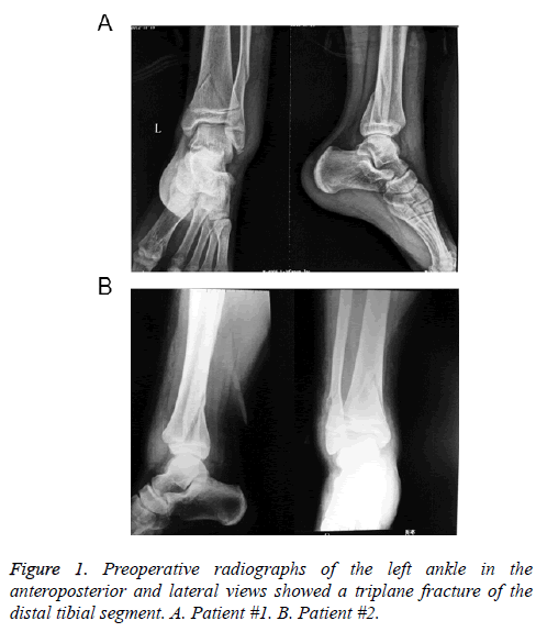 biomedres-radiographs-ankle