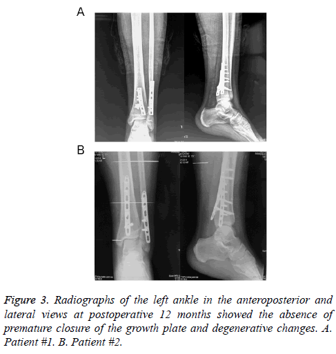 biomedres-radiographs-anteroposterior