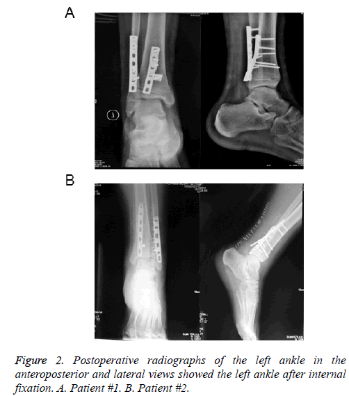 biomedres-radiographs-left-ankle