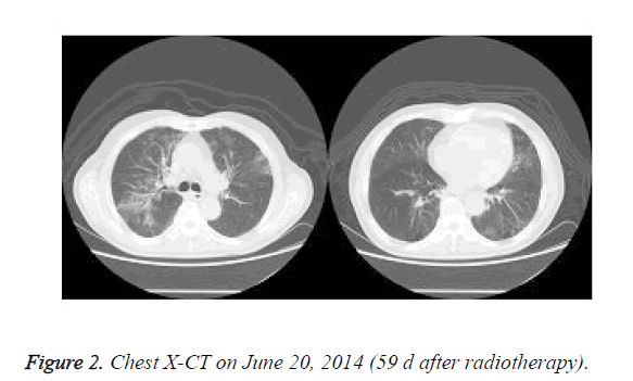 biomedres-radiotherapy