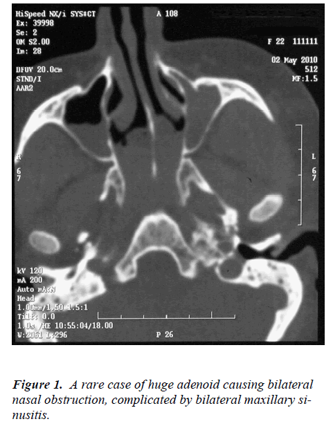 biomedres-rare-case