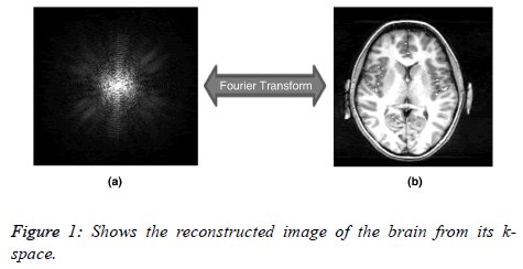 biomedres-reconstructe-image