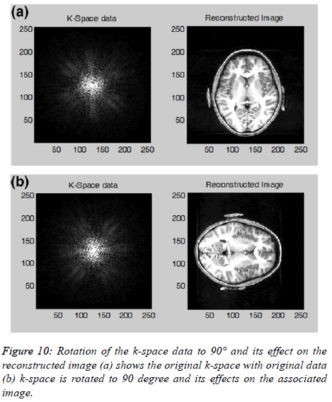 biomedres-reconstructed-image