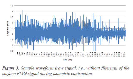 biomedres-record-Sample-waveform