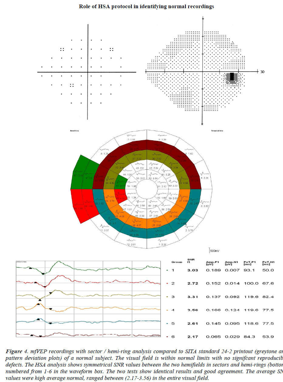 biomedres-recordings-with-sector