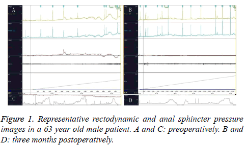 biomedres-rectodynamic-sphincter