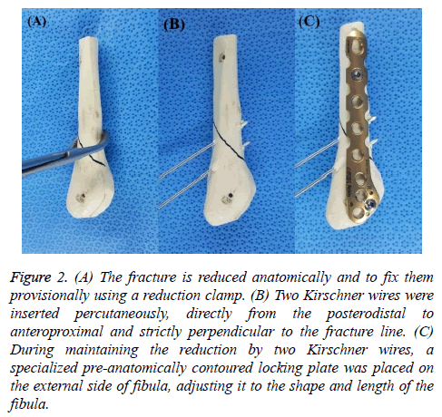 biomedres-reduction-clamp