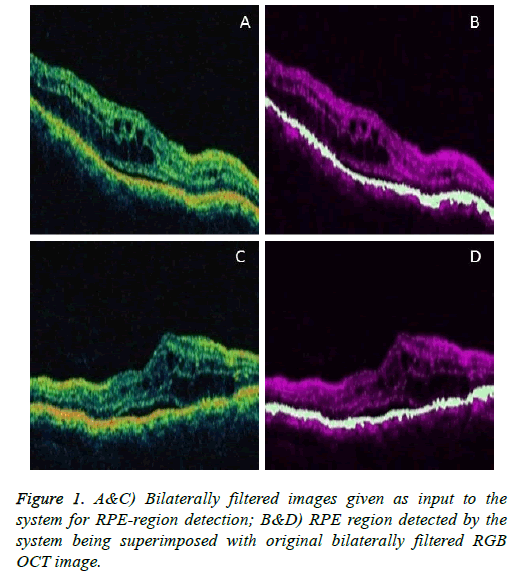 biomedres-region-detection