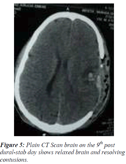 biomedres-relaxed-brain-resolving