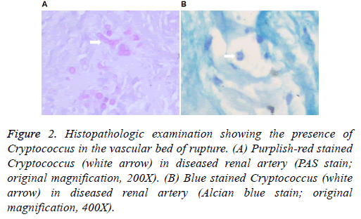 biomedres-renal-artery