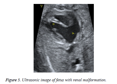 biomedres-renal-malformation