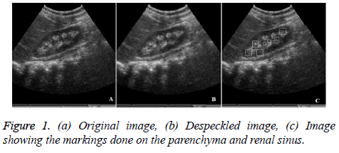 biomedres-renal-sinus