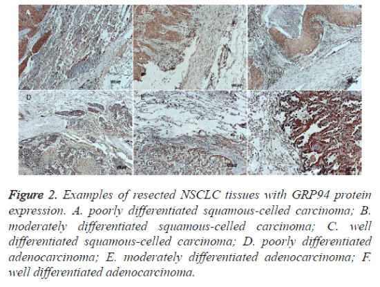 biomedres-resected-NSCLC