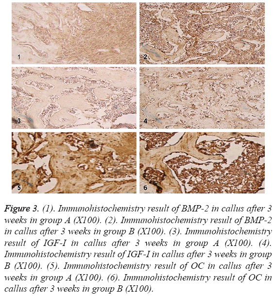 biomedres-result-IGF-I-callus