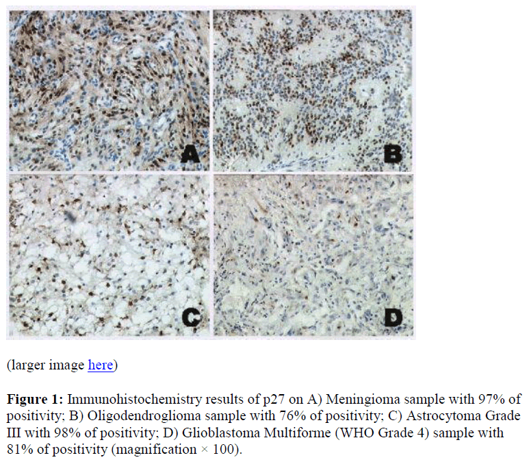 biomedres-results-Meningioma-positivity