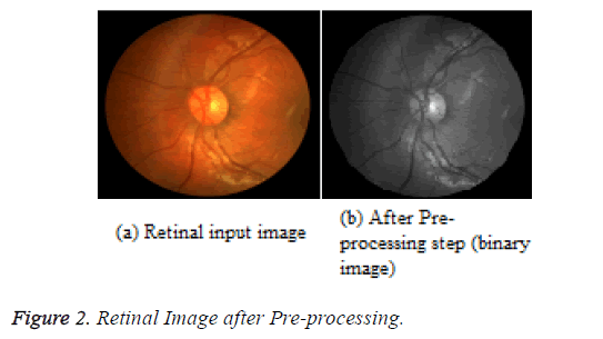 biomedres-retinal-image