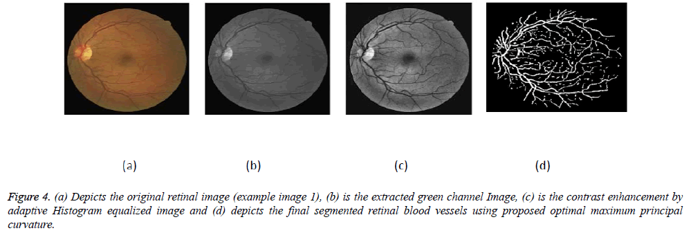 biomedres-retinal-image