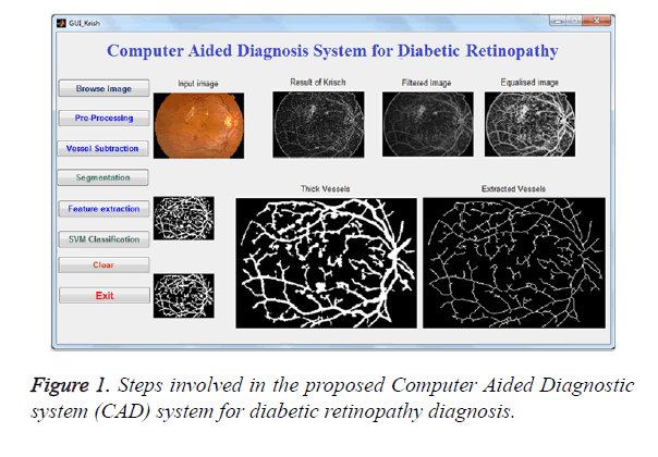 biomedres-retinopathy-diagnosis