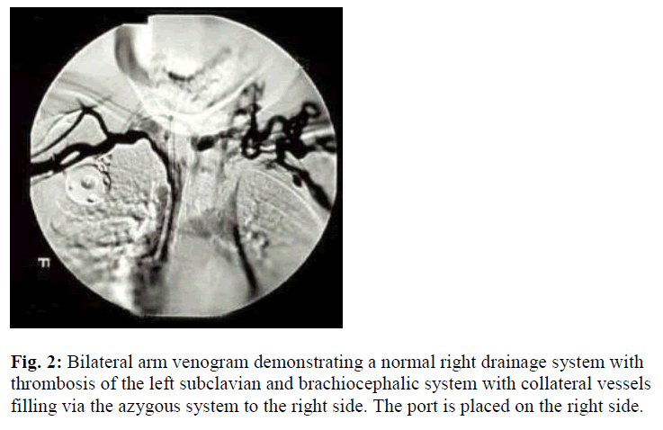 biomedres-right-drainage-system