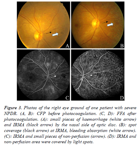 biomedres-right-eye-ground