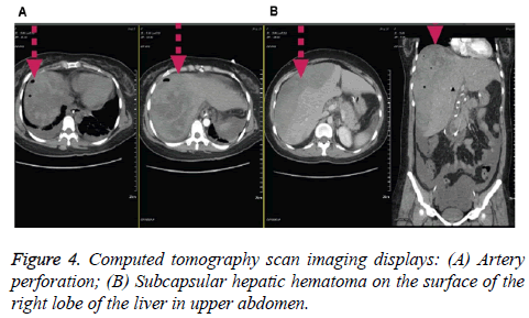 biomedres-right-lobe